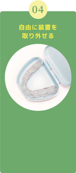 自由に装置を取り外せる