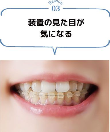 装置の見た目が気になる